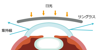 紫外線が隙間から入り込んだ様子